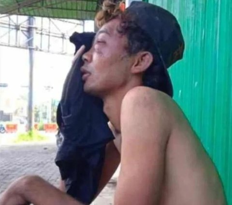 Tragis dan Memilukan, Pengamen Keterbelakangan Mental Dipukuli  dan Uangnya Dirampas Orang Tak Dikenal