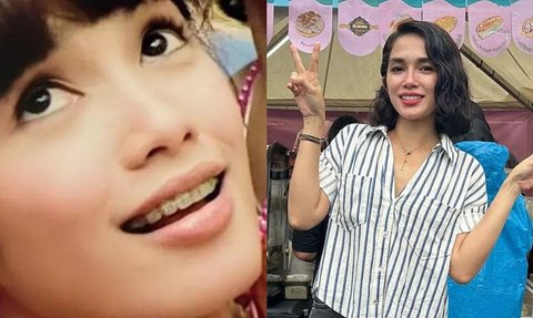 11 Transformasi Artis Sebelum dan Sesudah Pemasangan Behel Gigi, Mulai Dari Ussy Hingga Luna Maya