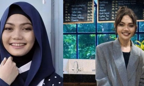 11 Transformasi Artis Sebelum dan Sesudah Pemasangan Behel Gigi, Mulai Dari Ussy Hingga Luna Maya