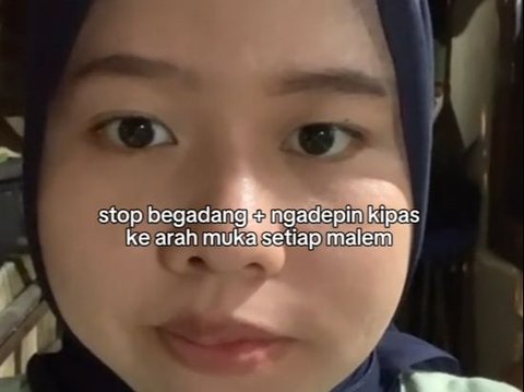 Viral Kisah Wanita Idap Bell's Palsy, Diduga Penyebabnya karena Angin dari Kipas