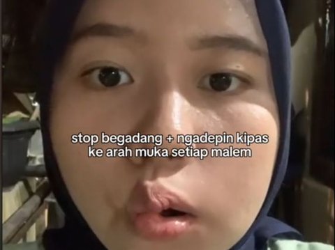 Viral Kisah Wanita Idap Bell's Palsy, Diduga Penyebabnya karena Angin dari Kipas