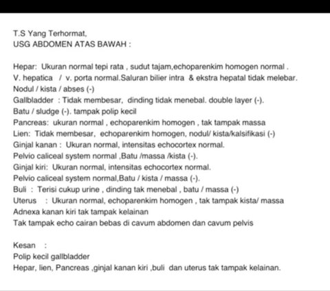 Idap Polip Kantong Empedu, Wanita Ini Peringatkan agar Tak Makan Pedas dan Makanan Instan