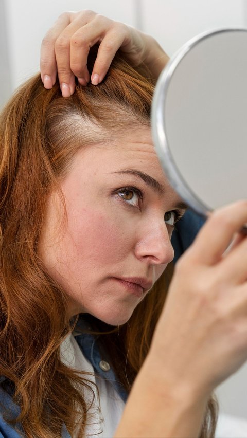 5 Kesalahan Sepele yang Bikin Rambut Rontok, Salah Satunya Cara Keramas yang Salah