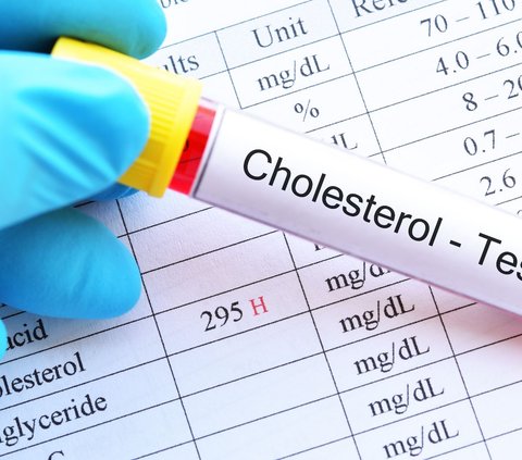 Uncontrolled Eating During Eid? This is a Safe Way to Lower Cholesterol