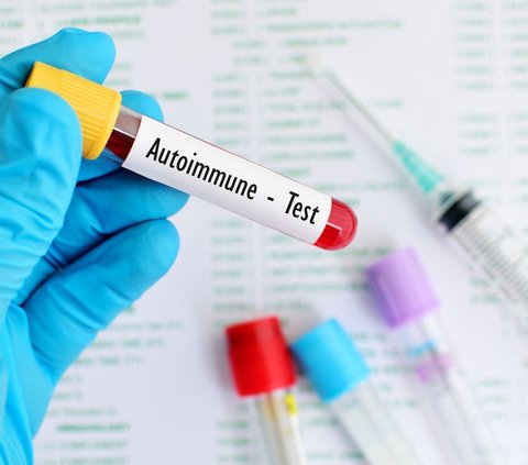 Reasons Why Women Are More Susceptible to Autoimmune Diseases