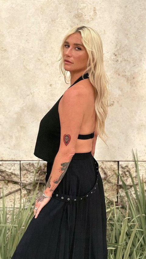 Kesha  <br>