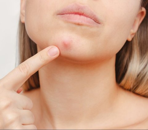 Father's Chat Soothes Daughter About Acne Making Her 'Meleyot'