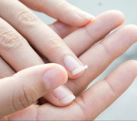 What Causes Brittle Nails? Here are Tips to Strengthen Them