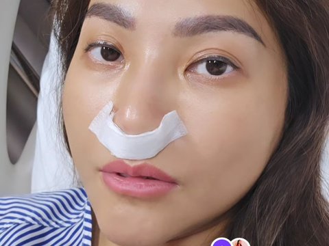 Kondisi Terbaru Sarwendah Usai Jalani Operasi dengan Hidung Diperban, Sakit Apa?