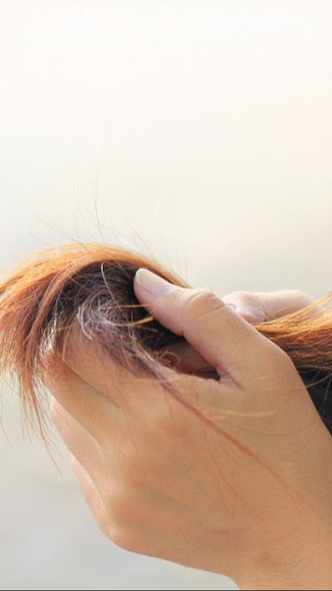 Alternatif Pencegahan Kerontokan Rambut yang Perlu Dipertimbangkan
