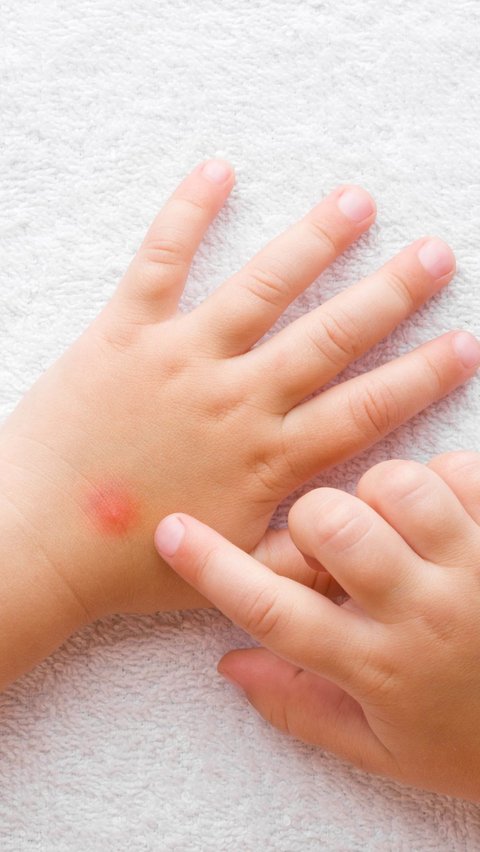 <b>Cara Mencegah Gigitan Nyamuk pada Anak, Lindungi si Kecil dari Demam Berdarah</b>