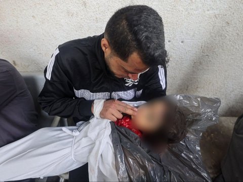 FOTO: Kisah Pilu Ayah Palestina Menangis Histeris Peluk Dua Putrinya yang Tewas Akibat Serangan Israel