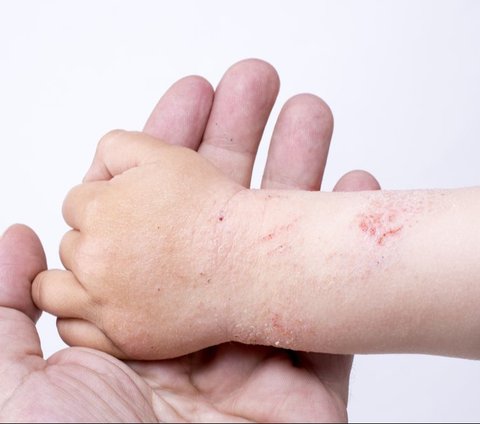 Prevent Sweat Rash in Little Ones During the Return Journey