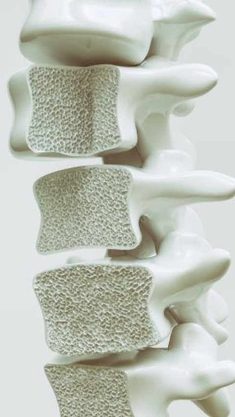 Penyebab Tulang Keropos yang Sering Diabaikan, Begini Cara Mencegahnya<br>