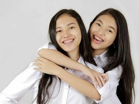 10 Potraits of Memories of the Twins Melisha and Melitha Sidabutar who Passed Away on the 8th, Both are Indonesian Idol Contestants