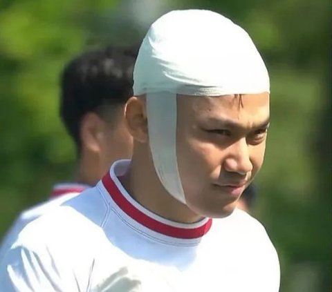 8 Photos of Witan Sulaeman with Bandage on His Head during Indonesia Vs Guinea Went Viral, Netizens: Looks Like Wearing a Peci