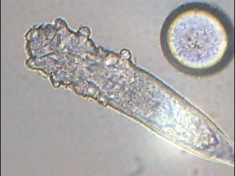 <b>Demodex folikulorum</b><br>