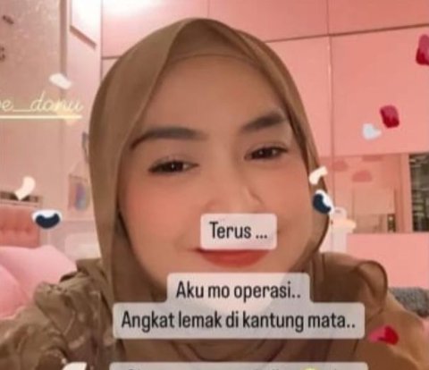 Facts about Ria Ricis' Desired Eyebag Removal Surgery