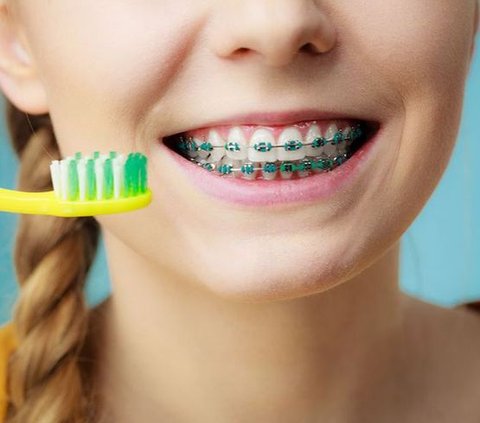 Different from the Usual, Here's How to Choose a Special Toothbrush for Brace Users