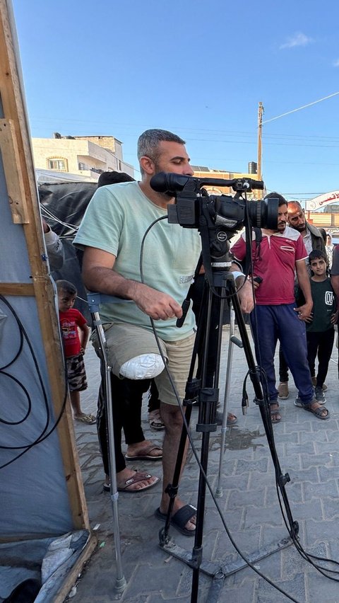 FOTO: Kisah Jurnalis Palestina Tetap Meliput Perang di Jalur Gaza Meski Kaki Diamputasi