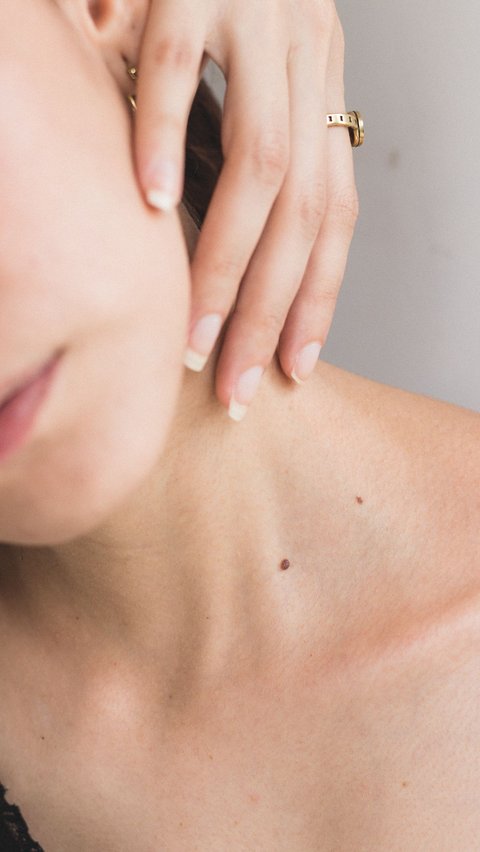 <b>Cara Menghilangkan Keloid dengan Bahan Alami, Lakukan di Rumah</b>