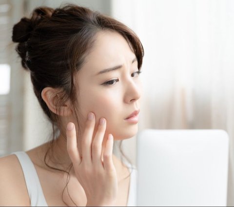 5 Keys to Prevent Severe Acne During Menstruation