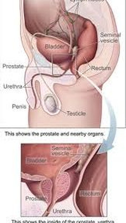 Gejala Kanker Penis, Lengkap Beserta Penyebab dan Cara Mengatasinya