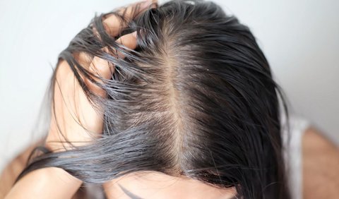 Content Ingredients for Oily and Dandruff Scalp