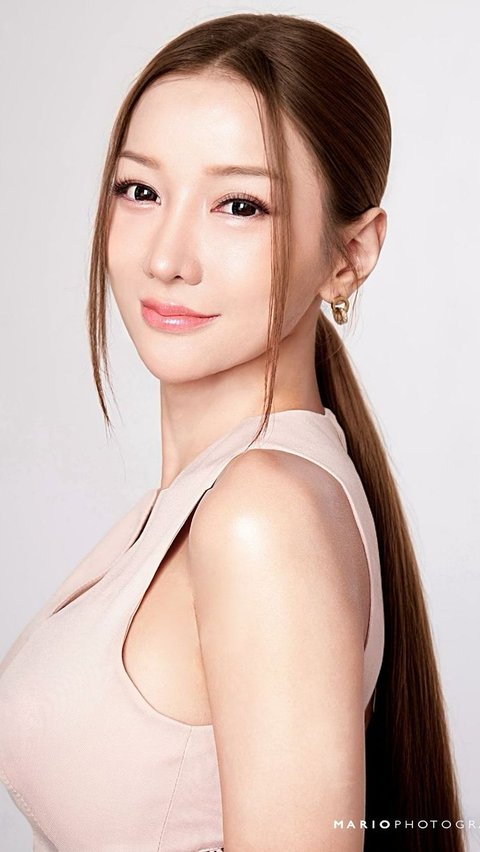 Fakta-fakta Prosedur Kecantikan Stem Cell yang Bikin Lucinta Luna bak Gadis Korea