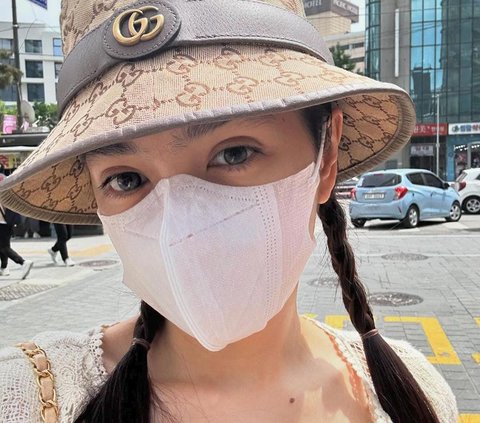 Akhirnya Terungkap! Potret Wajah Angel Karamoy Usai Oplas di Korea, Cantiknya Dipuji Natural Gak Lebay