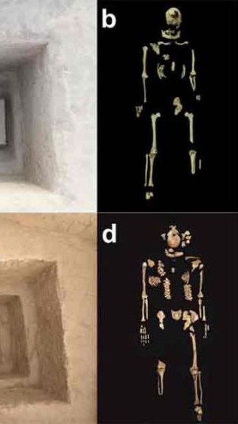 Identitas 2 Kerangka Kuno dengan 'Kaki Terputus' di China Terungkap, Bongkar Hukuman Zaman Dulu ke para Bangsawan