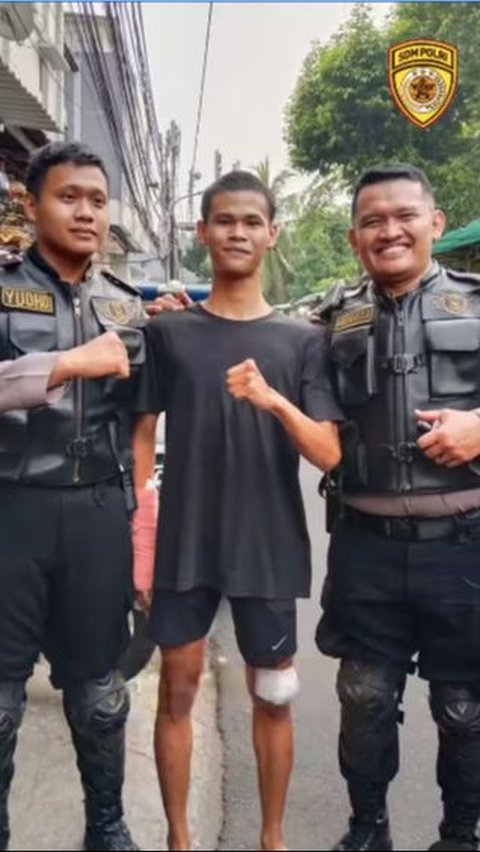 Tangan Masih Diperban, ini Janji Casis Korban Begal ke Kapolri Usai Lolos jadi Bintara