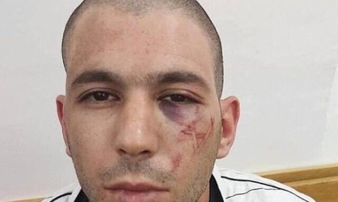 Bikin Cap Simbol Bintang Daud di Wajah Tahanan Palestina, Tujuh Polisi Israel Diadili