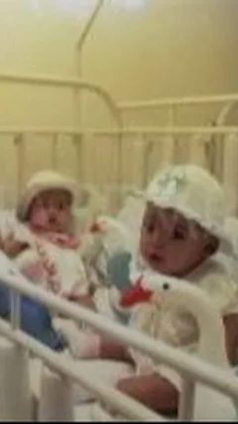 Bayi Kembar Siam Pertama Indonesia, Kini Nasibnya Cemerlang Sukses Jadi Dokter Dulu Ditolong Sosok ‘Malaikat tak Bersayap'