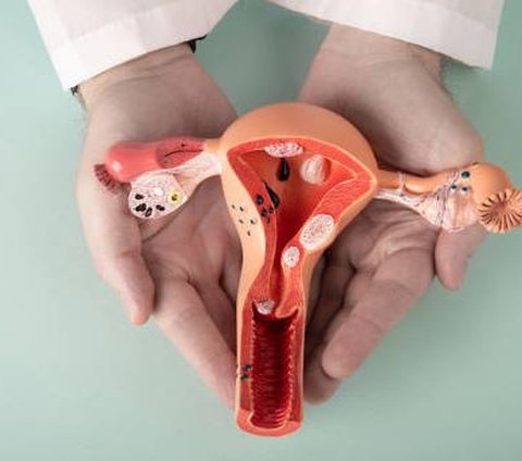 Faktor Risiko Kanker Ovarium yang Perlu Diwaspadai, Ketahui Cara Mencegahnya