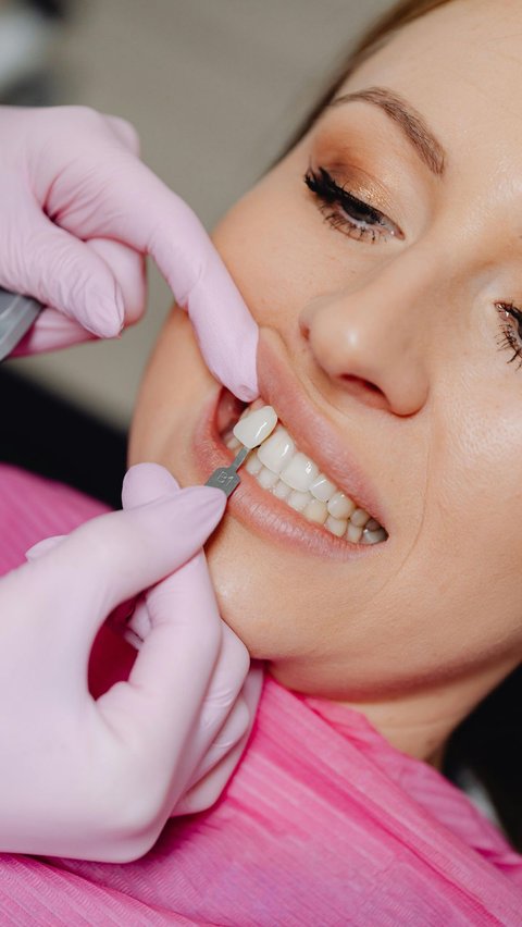 Types, Side Effects, and Prices of Dental Veneers Widely Used by Artists in Indonesia.