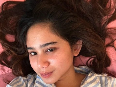 Portraits of Celebrities Without Makeup, Focused on Shandy Aulia's Pose when Just Waking Up