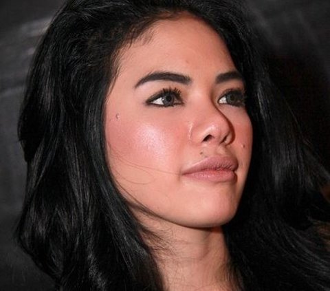 9 Transformasi Artis Sebelum dan Sesudah Filler Dagu, Wajah Makin Tirus Bikin Pangling