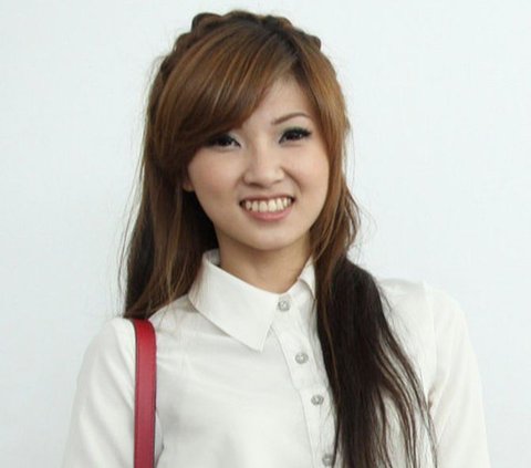 Dagu Sarwendah tampak lebih tajam dengan efek yang tirus, menambah pesonanya. Ternyata, dia telah melakukan filler dagu untuk