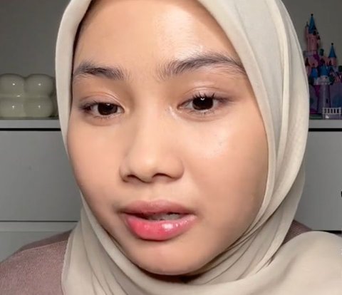 Panic Complexion 'Bolong' ? Can't Be Covered with Powder, Try This Method