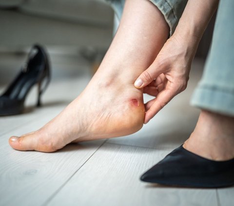 Initially Scratched Because of Wearing Shoes, This Woman Did Not Expect Her Foot to Be Amputated