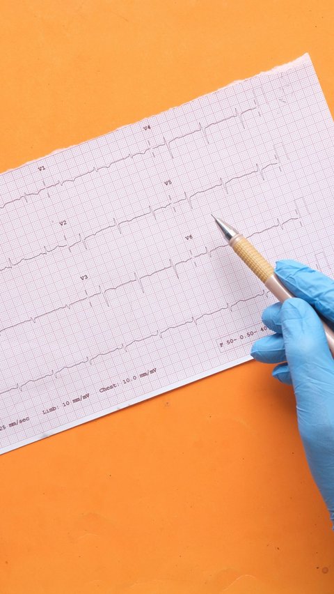 Bahaya Silent Stroke yang Bisa Terjadi Tanpa Disadari, Ketahui Langkah Antisipasinya