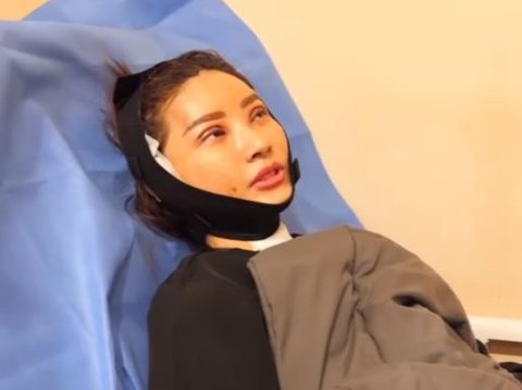 After being sued for divorce by Ruben Onsu, Sarwendah chooses to beautify herself with plastic surgery in South Korea