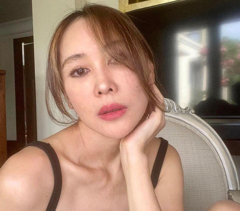 Potret Terbaru Ina Istri Jeremy Thomas Lakukan Oplas Facelift di Korea Selatan,  Hasilnya Bikin Melongo!