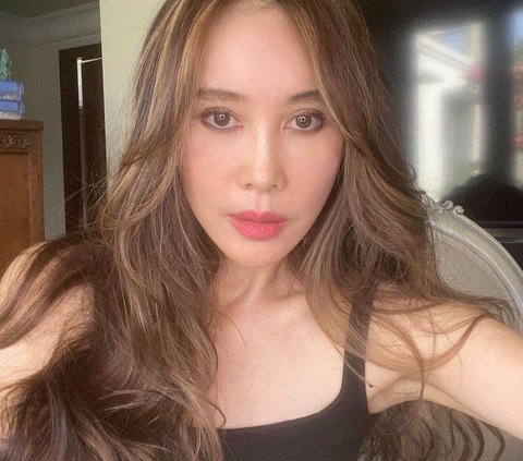 Potret Terbaru Ina Istri Jeremy Thomas Lakukan Oplas Facelift di Korea Selatan,  Hasilnya Bikin Melongo!