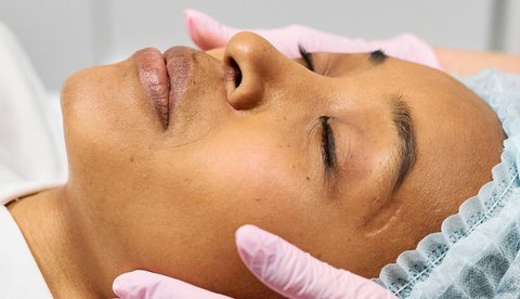 3. Microdermabrasion