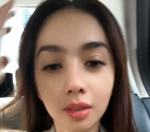 Latest Portrait of Angel Karamoy's Face After 3 Months of Plastic Surgery, Netizens: 