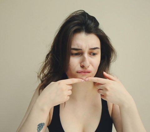 Pimple patch dapat membantu meredakan peradangan dan mempercepat penyembuhan jerawat pada wajah. (Foto: Pexels/Polina Tankilevitch)