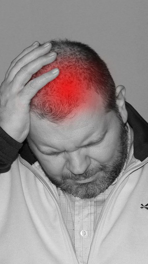 8 Penyebab Sakit Kepala Berdenyut, Migrain hingga Efek Minum Alkohol Berlebihan