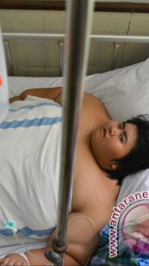 Ahli Nutrisi dan Penyakit Metabolik Anak FKUI Rumah Sakit Cipto Mangunkusumo (RSCM), Klara Yuliarti mengungkapkan ciri-ciri anak mengalami obesitas.